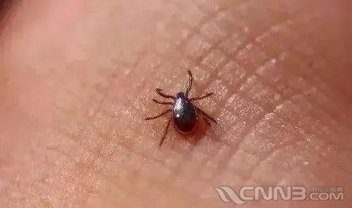 看到这种虫子要小心!宁波男子被咬后,连续高烧39度,恶心干呕!