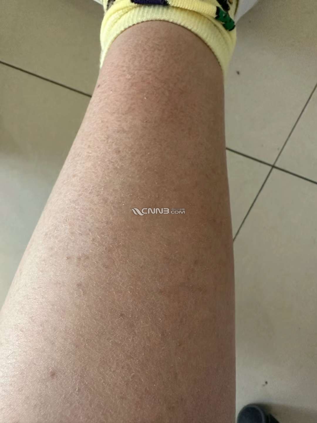 1730790461644719_156.png